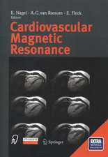 Cardiovascular Magnetic Resonance