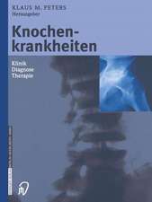 Knochenkrankheiten: Klinik Diagnose Therapie