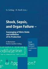 Shock, Sepsis, and Organ Failure: Scavenging of Nitric Oxide and Inhibition of its Production