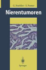 Nierentumoren: Grundlagen, Diagnostik, Therapie