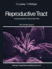 The Human Female Reproductive Tract: A Scanning Electron Microscopic Atlas