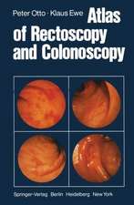 Atlas of Rectoscopy and Coloscopy