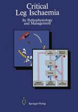 Critical Leg Ischaemia: Its Pathophysiology and Management