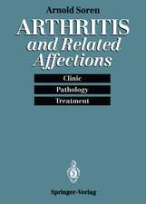 Arthritis and Related Affections: Clinic, Pathology, and Treatment