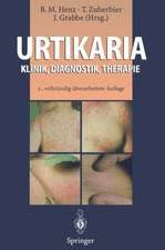 Urtikaria: Klinik, Diagnostik, Therapie