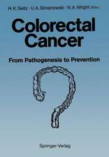 Colorectal Cancer