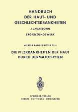 Die Pilzkrankheiten der Haut durch Dermatophyten