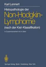 Histopathologie der Non-Hodgkin-Lymphome: (nach der Kiel-Klassifikation)