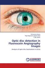 Optic disc detection in Fluorescein Angiography Images