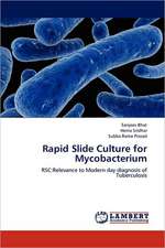 Rapid Slide Culture for Mycobacterium