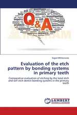 Evaluation of the etch pattern by bonding systems in primary teeth