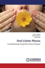 Oral Lichen Planus