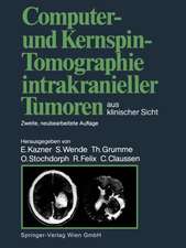 Computer- und Kernspin-Tomographie intrakranieller Tumoren aus klinischer Sicht