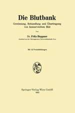 Die Blutbank: Gewinnung, Behandlung und Übertragung von konserviertem Blut