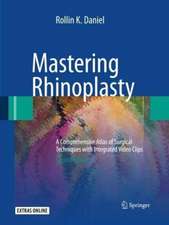 Mastering Rhinoplasty: A Comprehensive Atlas of Surgical Techniques with Integrated Video Clips