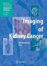 Imaging of Kidney Cancer