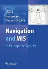 Navigation and MIS in Orthopedic Surgery