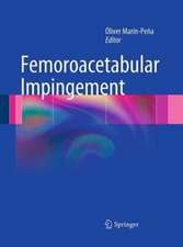 Femoroacetabular Impingement