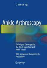 Ankle Arthroscopy: Techniques Developed by the Amsterdam Foot and Ankle School