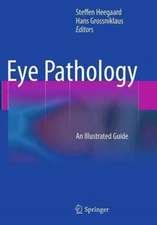 Eye Pathology: An Illustrated Guide