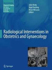 Radiological Interventions in Obstetrics and Gynaecology