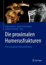 Die proximalen Humerusfrakturen: Eine chirurgische Herausforderung