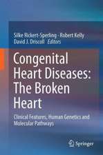 Congenital Heart Diseases: The Broken Heart: Clinical Features, Human Genetics and Molecular Pathways