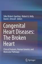 Congenital Heart Diseases: The Broken Heart: Clinical Features, Human Genetics and Molecular Pathways