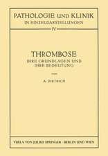 Thrombose: Ihre Grundlagen und ihre Bedeutung