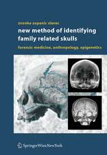 New Method of Identifying Family Related Skulls: Forensic Medicine, Anthropology, Epigenetics