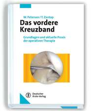 Das vordere Kreuzband