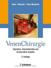 VenenChirurgie