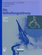 Die Hüftreifungsstörung: Diagnose und Therapie