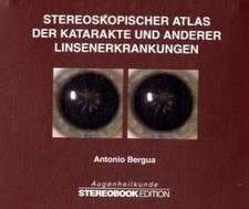 Stereoskopischer Atlas der Katarakte und anderer Linsenerkrankungen