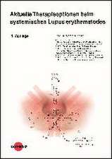 Aktuelle Therapieoptionen beim systemischen Lupus erythematodes