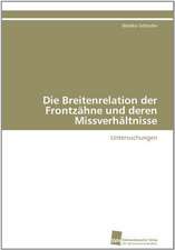 Die Breitenrelation Der Frontzahne Und Deren Missverhaltnisse: Ein Zytokin Der Il-10-Interferon-Familie