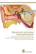 Horen Mit Und Ohne Horimplantaten: Measurement and Source Allocation