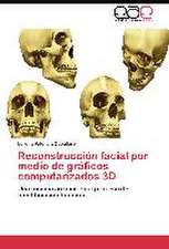 Reconstrucción facial por medio de gráficos computarizados 3D