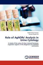 Role of AgNORs' Analysis in Urine Cytology