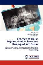 Efficacy of PRP in Regeneration of Bone and Healing of soft Tissue