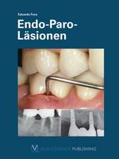 Endo-Paro-Läsionen