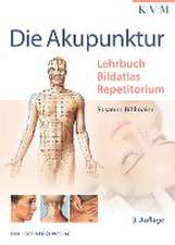 Die Akupunktur