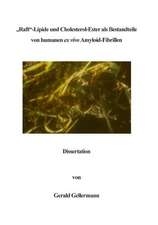 Raft -Lipide und Cholesterol-Ester als Bestandteile von humanen ex vivo Amyloid-Fibrillen