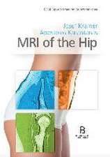 MRI of the Hip