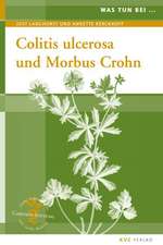 Was tun bei Colitis ulcerosa und Morbus Crohn