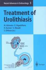 Treatment of Urolithiasis