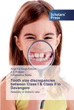 Tooth size discrepancies between Class I & Class II in Davangere