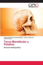 Torus Mandibular y Palatino