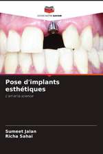 Pose d'implants esthétiques