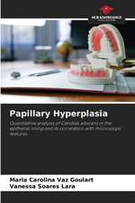 Papillary Hyperplasia